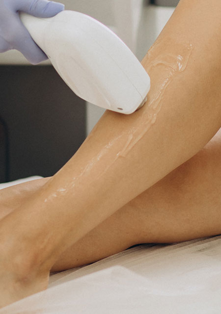 Épilation Laser